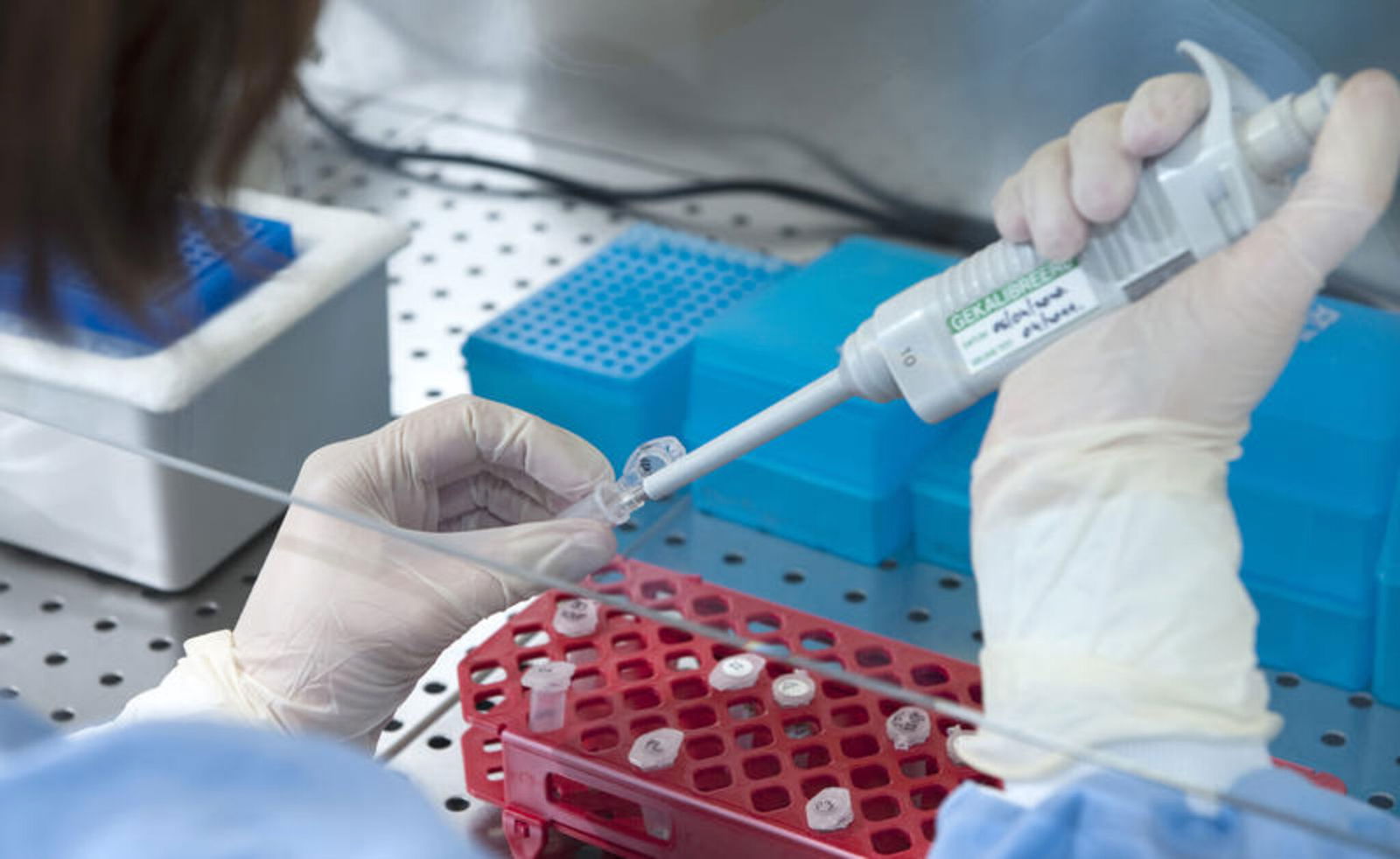 probe_labor_pränatal