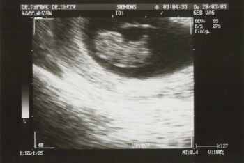 Ein besonderer Moment: Was geht einem jungen Mann durch den Kopf, der gerade Vater wird?