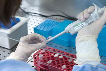 probe_labor_pränatal