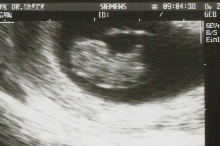 Ein besonderer Moment: Was geht einem jungen Mann durch den Kopf, der gerade Vater wird?